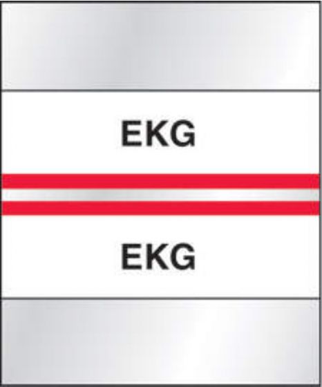 Chart Tab Paper Ekg Ekg 1 1/4" x 1 1/2" Red 100 per Package