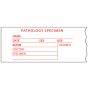 Lab Communication Tape (Removable)pathology Specimen 2" x500" White - 143 Imprints per Roll