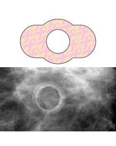 Spee-D-Ring™ Mammography Mole Skin Marker, Radiolucent, 100 Per Box, Pink, 1/2" Inner Diameter