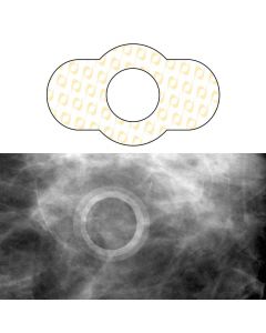 Spee-D-Ring™ Mammography Mole Skin Marker, Radiolucent, 100 Per Box, Yellow, 1/2" Inner Diameter