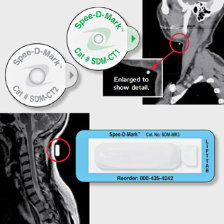 Spee-D-Mark CT & MRI Skin Markers